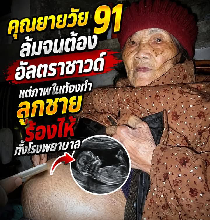 คุณยายวัย 91 ล้มจนต้องอัลตราซาวด์ แต่ภาพในท้องทำลูกชายร้องไห้ทั้งโรงพยาบาล!…
