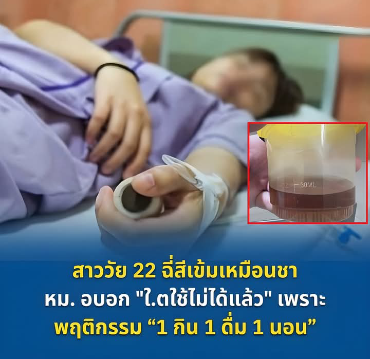 สาววัย 22 ฉี่สีเข้มเหมือนชา หมอบอก “ไ.ตใช้ไม่ได้แล้ว” เพราะพฤติกรรม “1 กิน 1 ดื่ม 1 นอน”