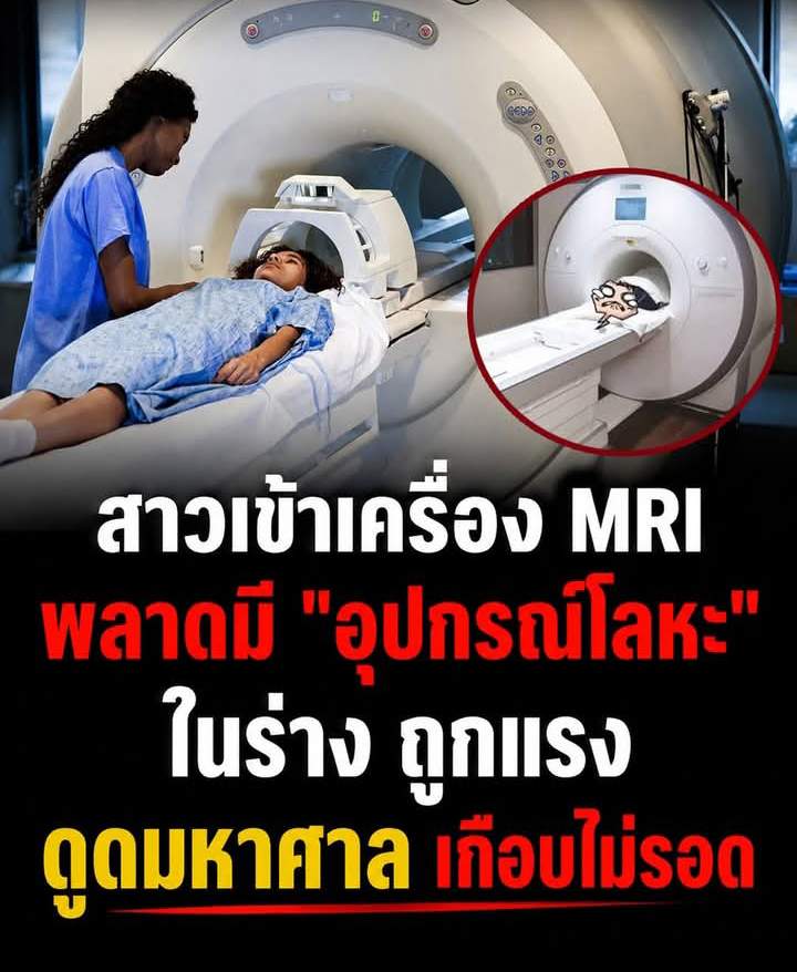 สาวเข้าเครื่อง MRI พลาดมี “อุปกรณ์โลหะ” ในร่างถูกแรง ดูดมหาศาลเกือบไม่ร.อด