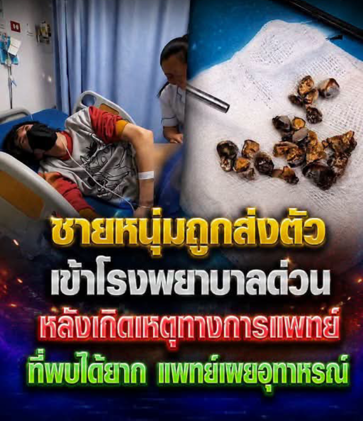 ชายหนุ่มถูกนำตัวส่งโรงพยาบาลด่วน หลังพบภาวะทางการแพทย์ ที่เกิดขึ้นได้ยาก แพทย์เผยเป็นอุทาหรณ์